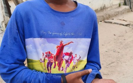 30వ వార్డులో కిరణ్ తేజ 8వ తరగతి విద్యార్థి పై కుక్కల దాడి తీవ్ర గాయాలు