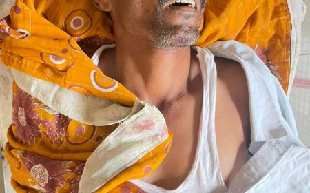 లారీ డీ ఒకరు మృతి