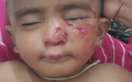 వీధి కుక్కల స్వైర విహారం