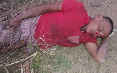 తాడి చెట్టు పై నుండి పడిన గీత కార్మికునికి గాయాలు