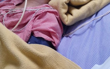 కుక్క అడ్డం రావడంతో బైక్ పై వెళుతున్న భార్యాభర్తలు కిందపడి భార్య కు  తలకు బలమైన గాయం*