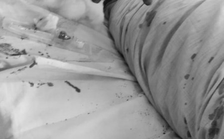 డ్రోను రెక్కలు తగిలి ఇద్దరికీ గాయాలు.. కర్నూలు ఆస్పత్రికి తరలింపు