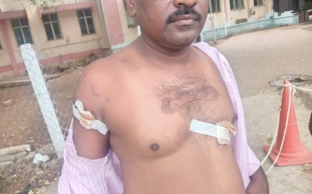 జమ్మిచెడులో 15 మందిపై పిచ్చికుక్క దాడి