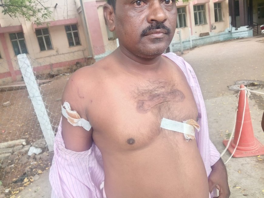 జమ్మిచెడులో 15 మందిపై పిచ్చికుక్క దాడి